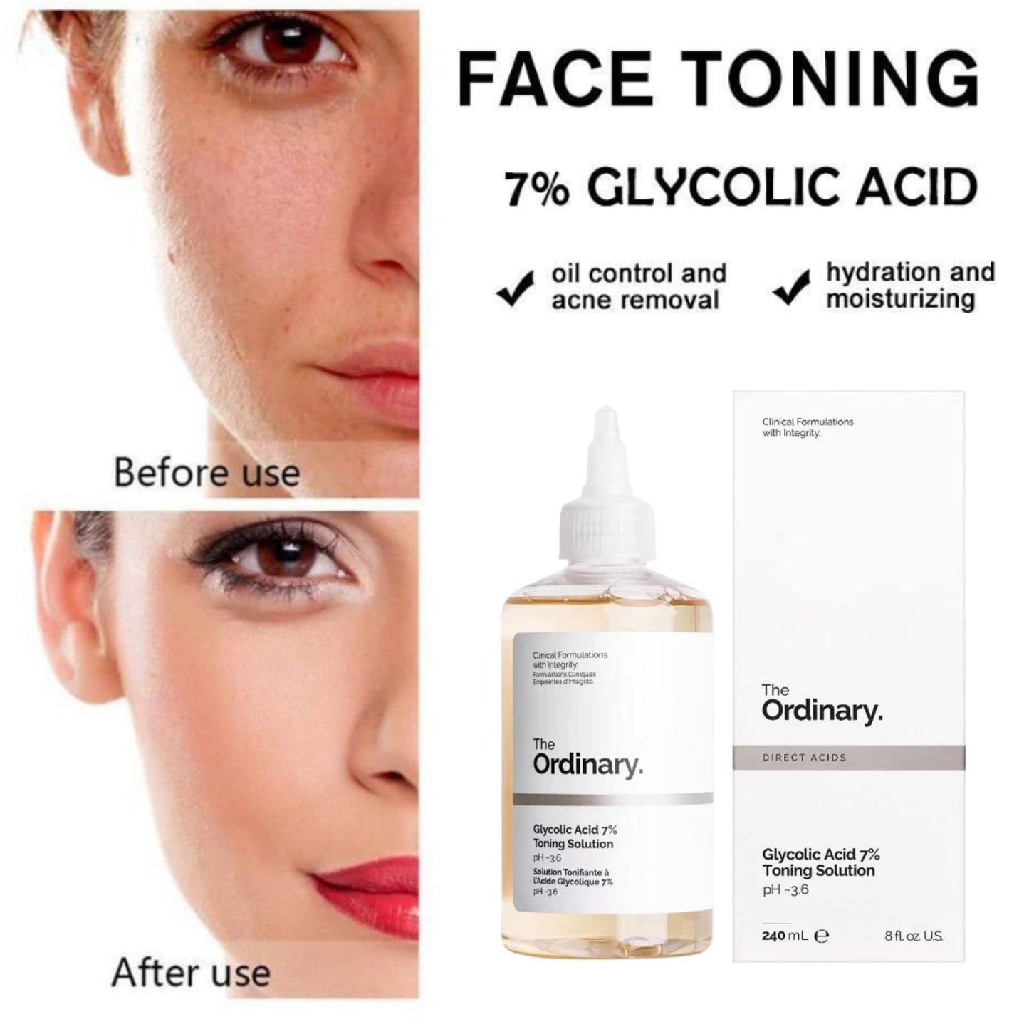Acido Glicolico al 7%, 100 mL, marca The Ordinary