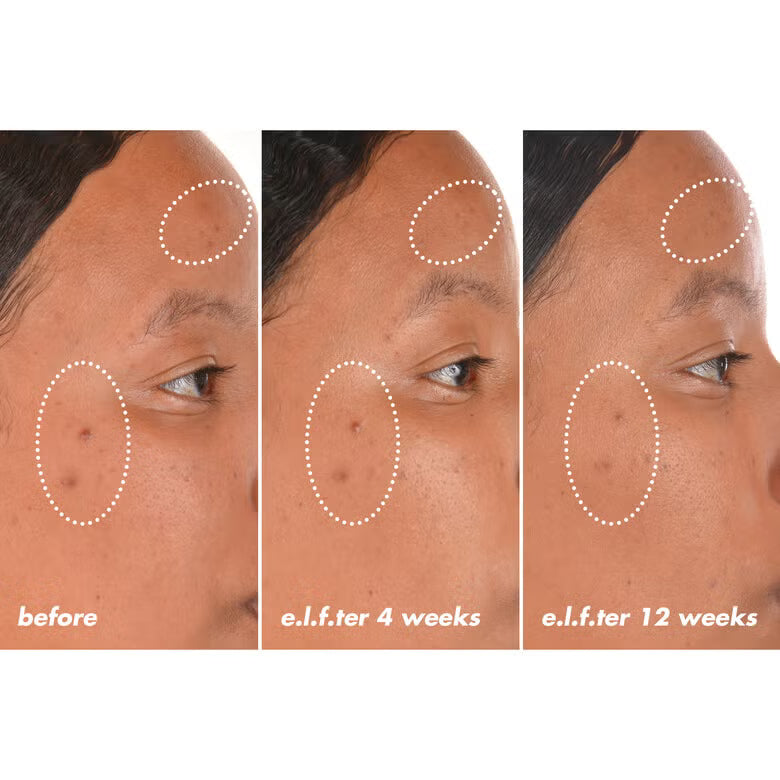 ✨🍊 Serum Bright Icon Vitamina C + E + Ácido Ferúlico – ELF SKIN 🍊✨